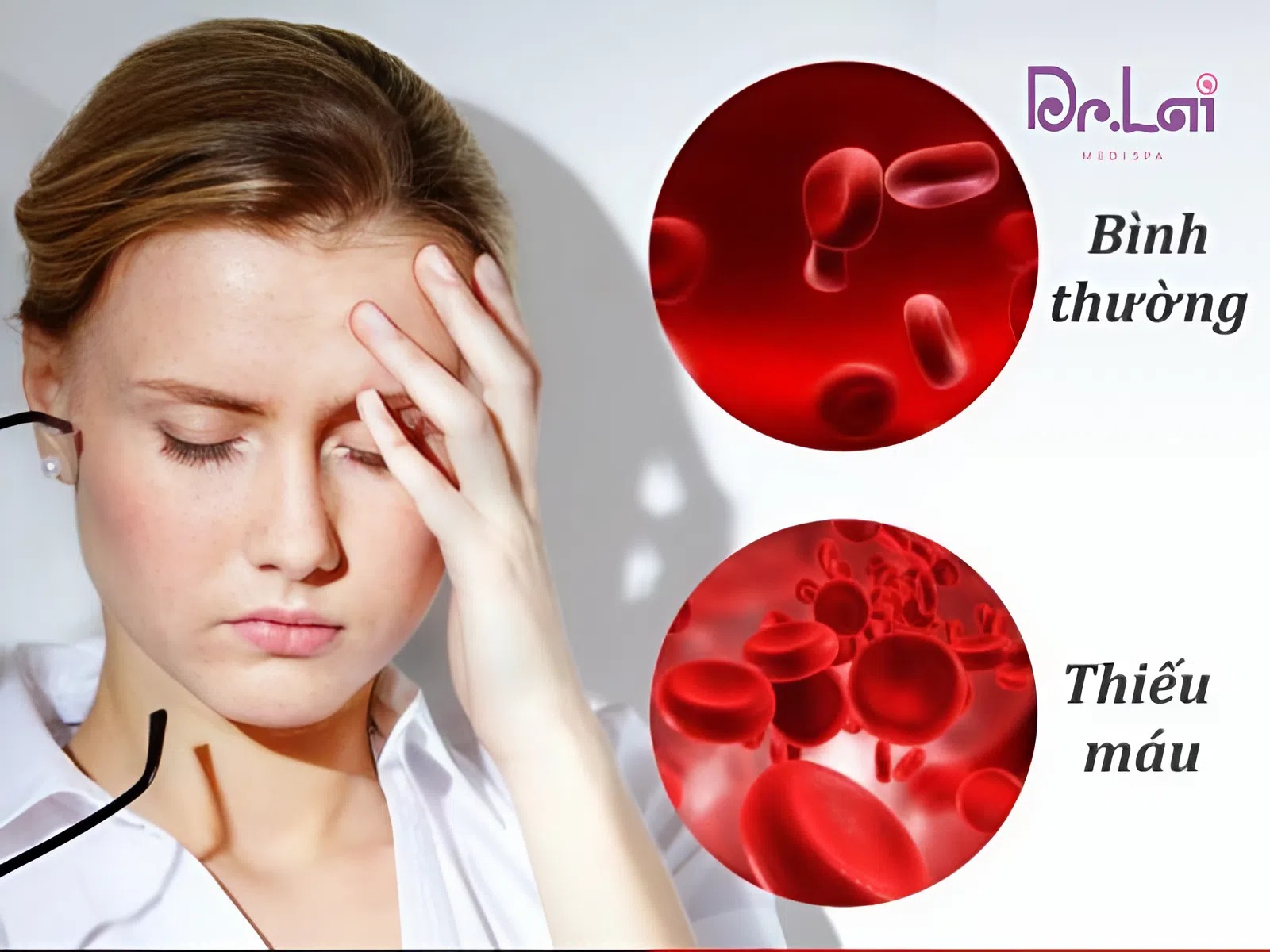 Thiếu máu thường mệt mỏi, chóng mặt