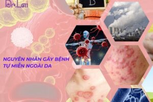 Bệnh tự miễn ngoài da