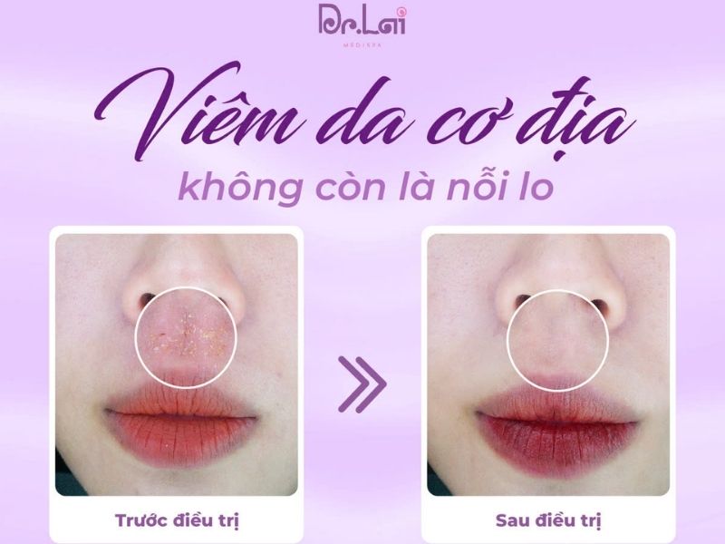 Ưu điểm khi trải nghiệm nhiều dịch vụ tại cùng 1 spa