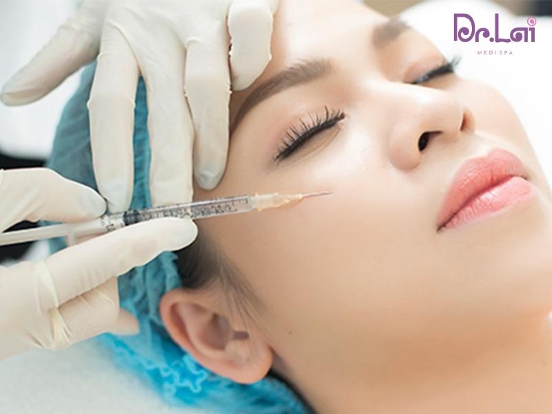 Tiêm Botox và Filler là một trong những phương pháp hiệu quả để xóa nếp nhăn