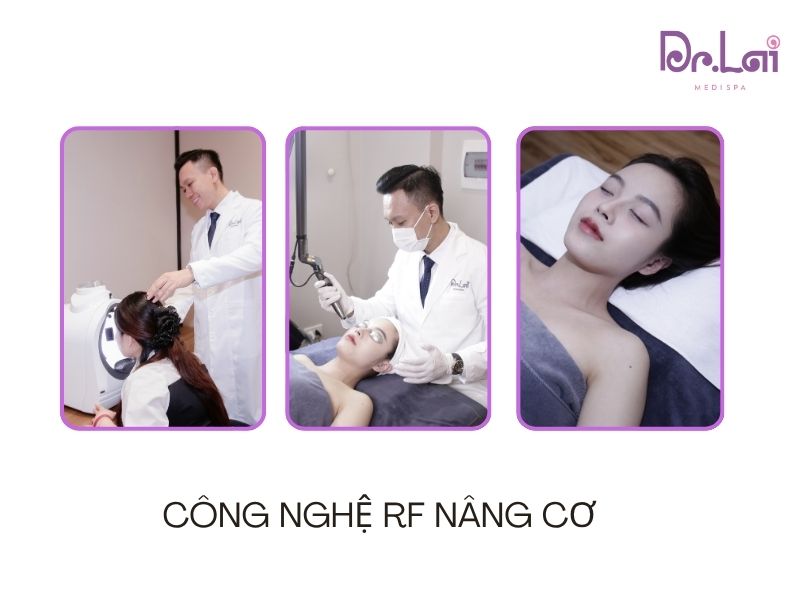 Công nghệ RF giúp nâng cơ và chăm sóc da