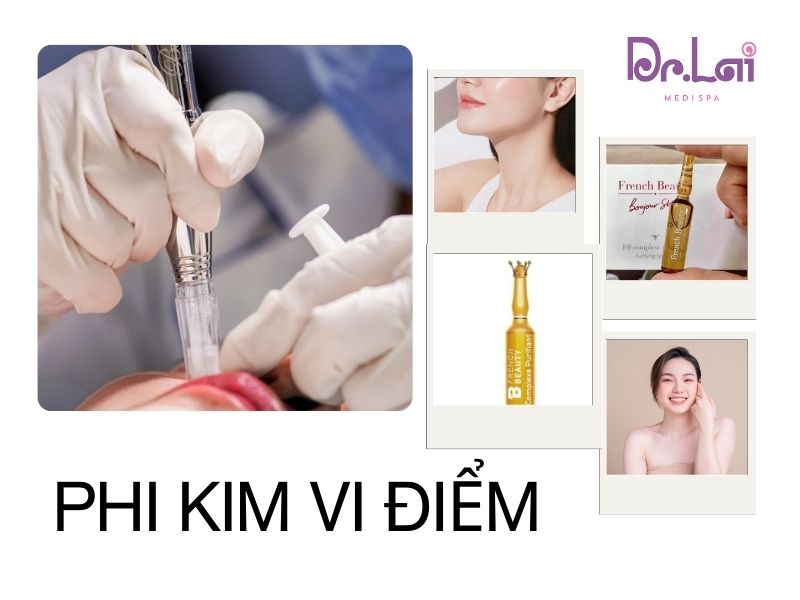 Những phương pháp điều trị mụn chuyên sâu hiệu quả cao