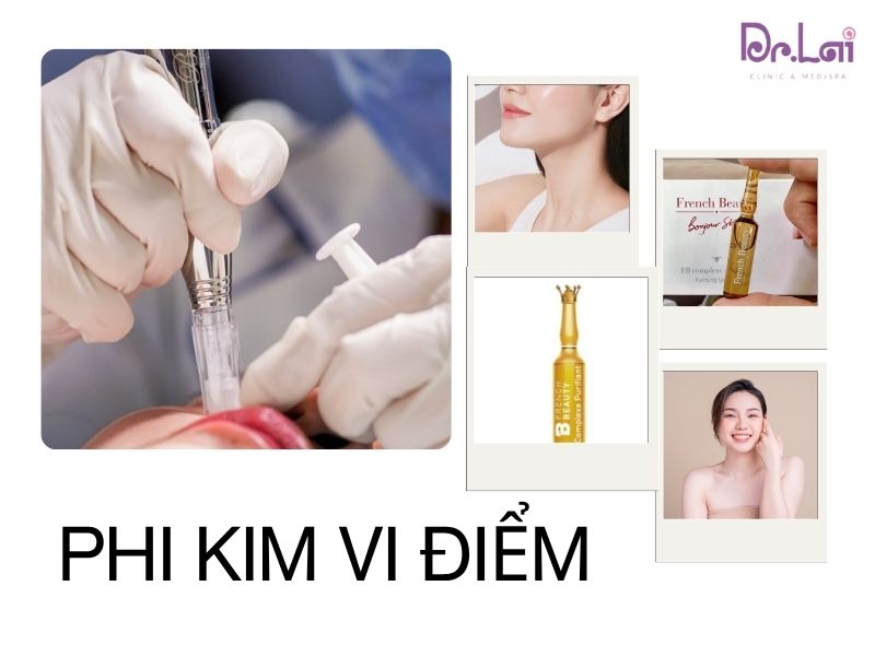 Phương pháp phi kim vi điểm