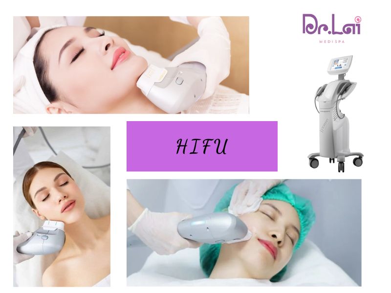 Công nghệ Hifu là gì