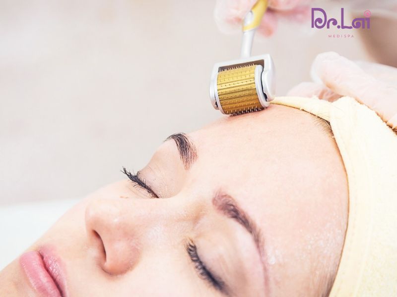 So sánh phương pháp phi kim vi điểm với các phương pháp khác