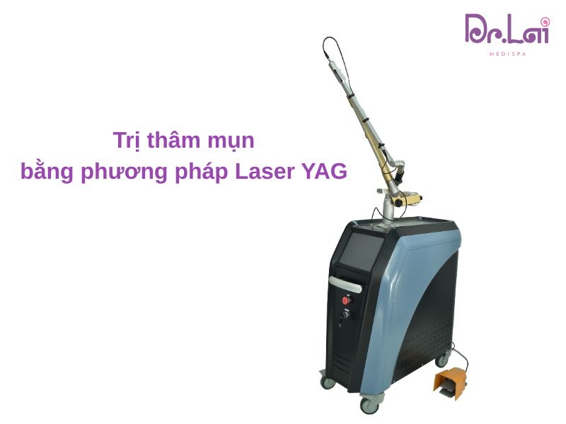 Công nghệ Laser YAG là gì?