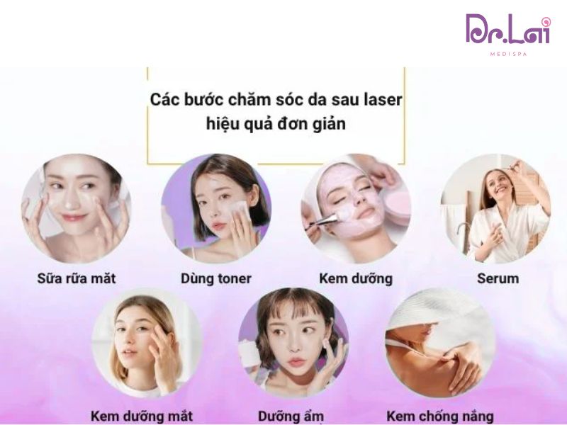 Lưu ý chăm sóc da sau khi trị thâm mụn bằng Laser YAG
