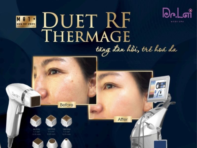 Phương pháp Thermage là gì?