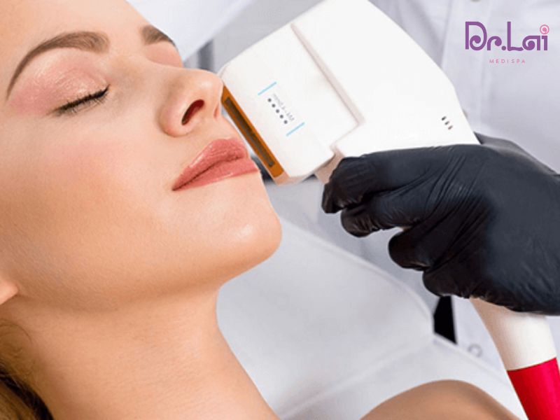 Công nghệ HIFU trẻ hóa da