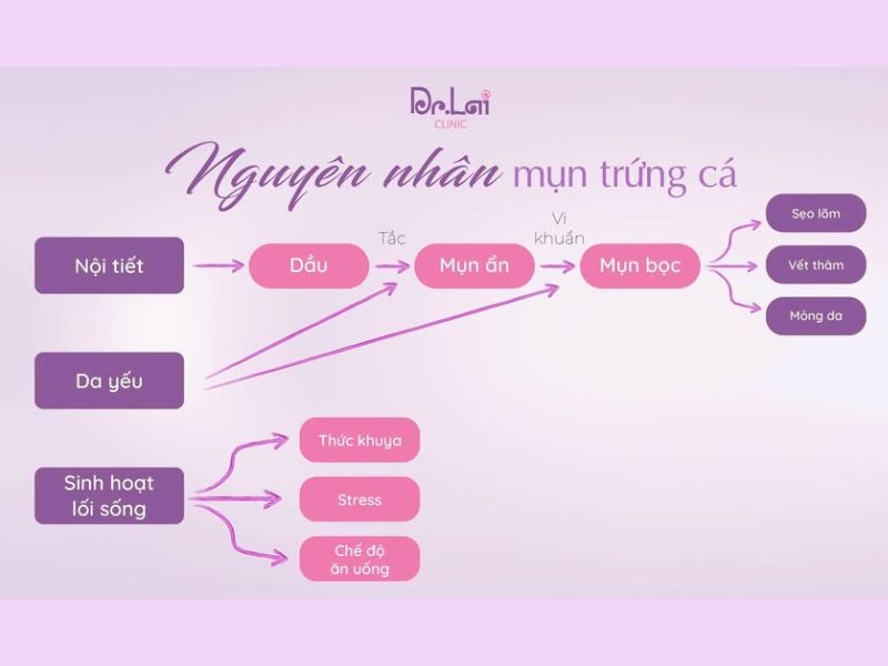 Nguyên nhân gây mụn ở cơ thể