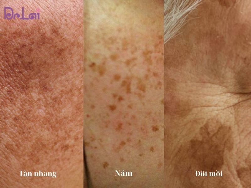 tri-nam-tan-nhang-doi-moi