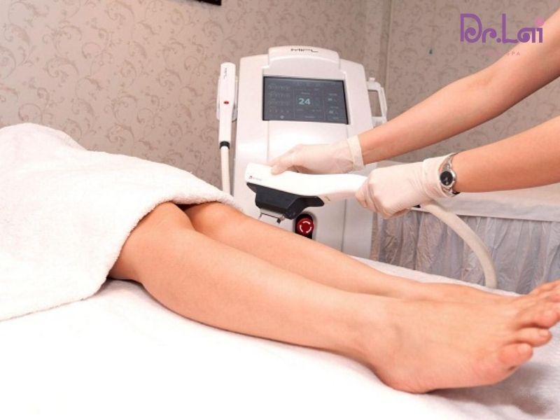 Công nghệ Laser IPL là gì?
