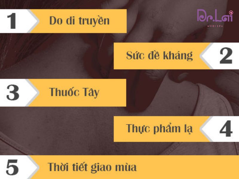 Nguyên nhân gây ra bệnh viêm da tiếp xúc