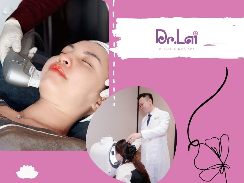 Công nghệ Hifu là gì?