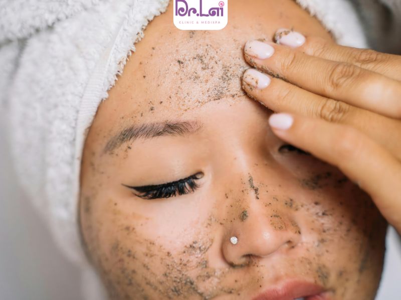 Cách chữa mụn ẩn ở má hiệu quả