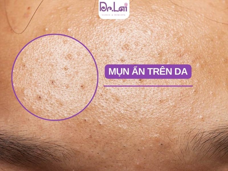 Khi nào cần gặp bác sĩ da liễu