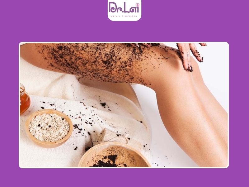 Cách điều trị mụn trứng cá ở lưng an toàn, hiệu quả