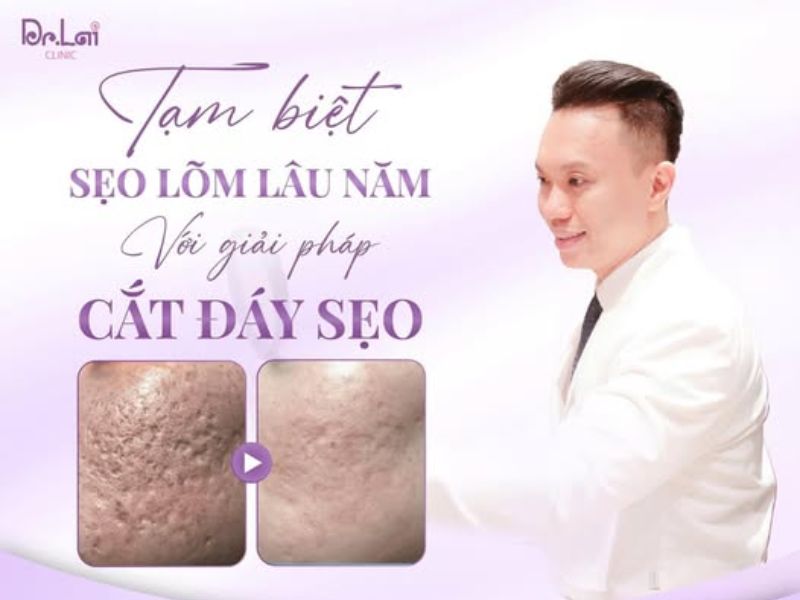 8 bước chăm sóc da sau khi cắt đáy sẹo để giảm thâm, giảm viêm