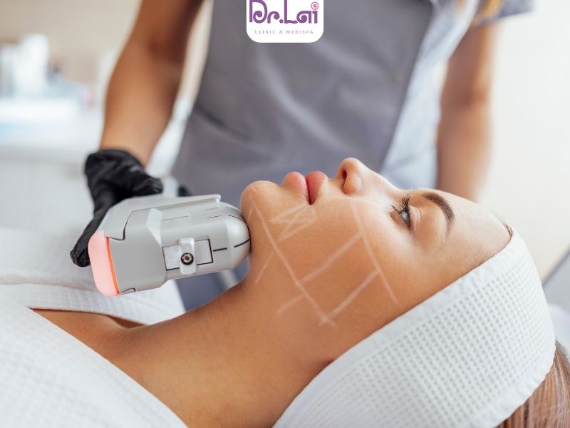 Làm HIFU có đau không