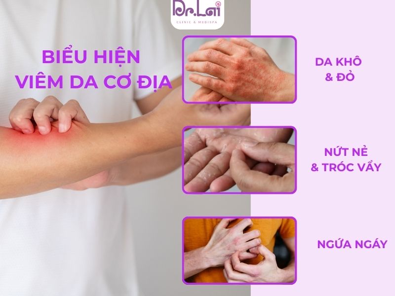 Các biểu hiện của viêm da tay theo từng giai đoạn