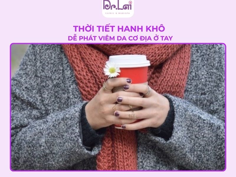 Thời tiết lạnh dễ tái phát viêm da cơ địa ở tay