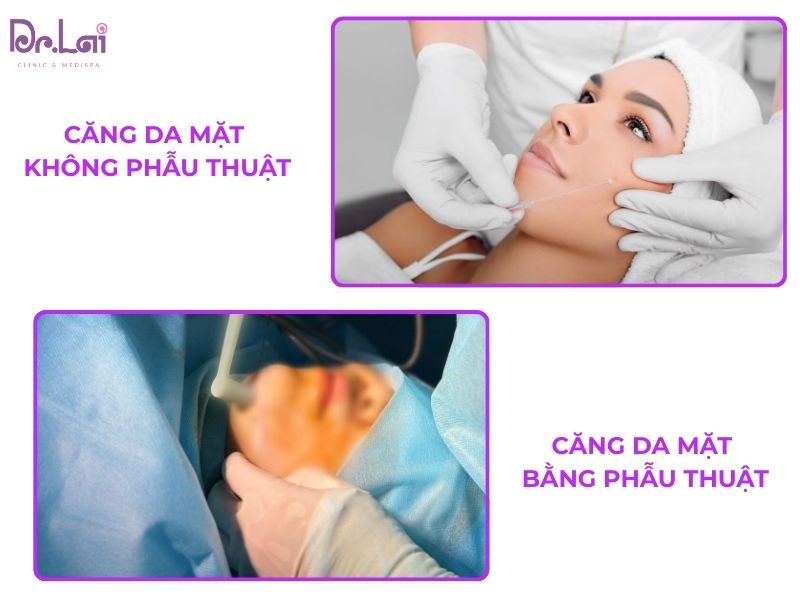 Căng da mặt có 2 phương pháp chính là phẫu thuật và không phẫu thuật