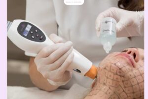 Tác dụng phụ của Thermage: Những rủi ro cần biết trước khi thực hiện