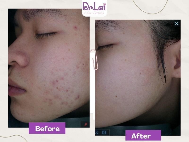 Feedback của khách hàng sau điều trị