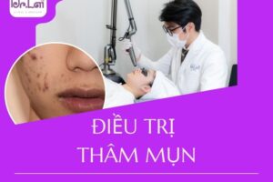Cách điều trị thâm mụn lâu năm: Tại sao dùng nhiều mỹ phẩm vẫn không hết?