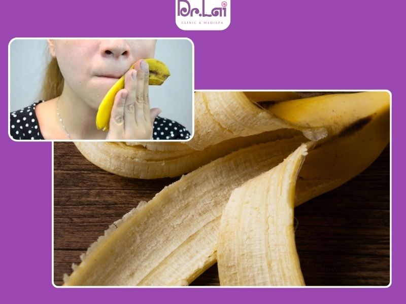 10+ cách trị mụn trứng cá ở trán an toàn hiệu quả nhất