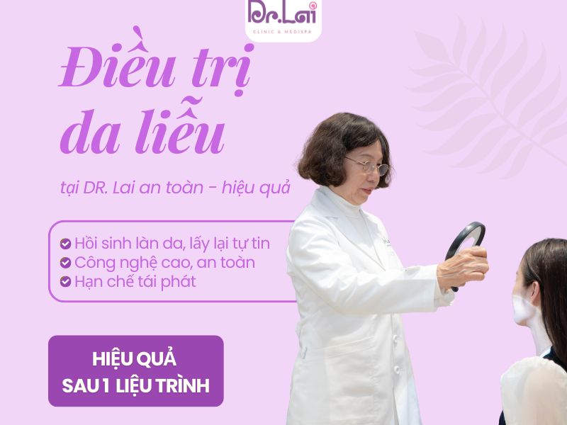 10+ cách trị mụn trứng cá ở trán an toàn hiệu quả nhất