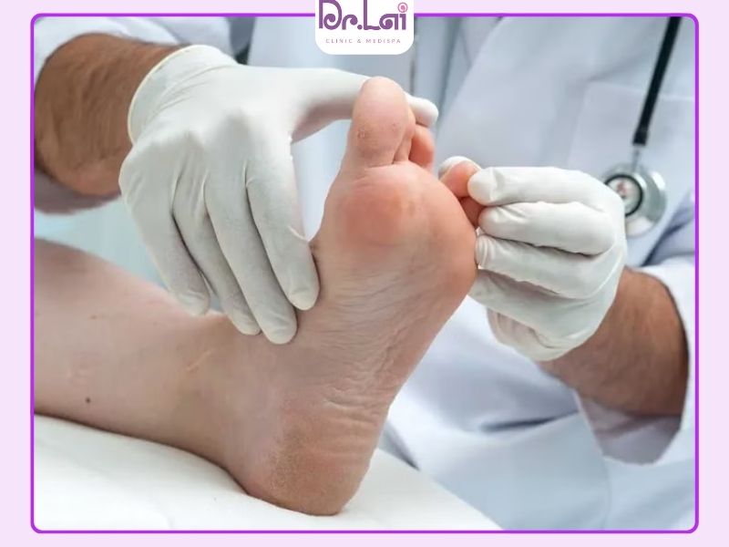 Chăm sóc và vệ sinh da khi bị viêm da cơ địa ở chân