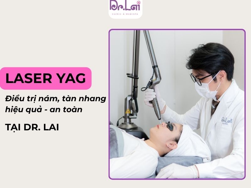 Laser YAG Q-switched là công nghệ điều trị nám, tàn nhan hiệu quả