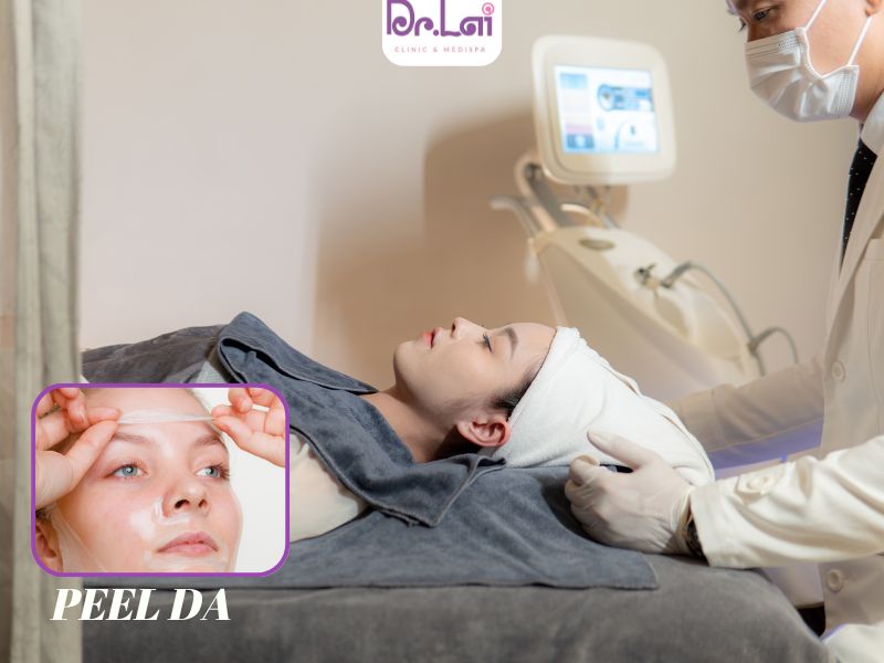 Cách trị thâm mụn ở mặt hiệu quả