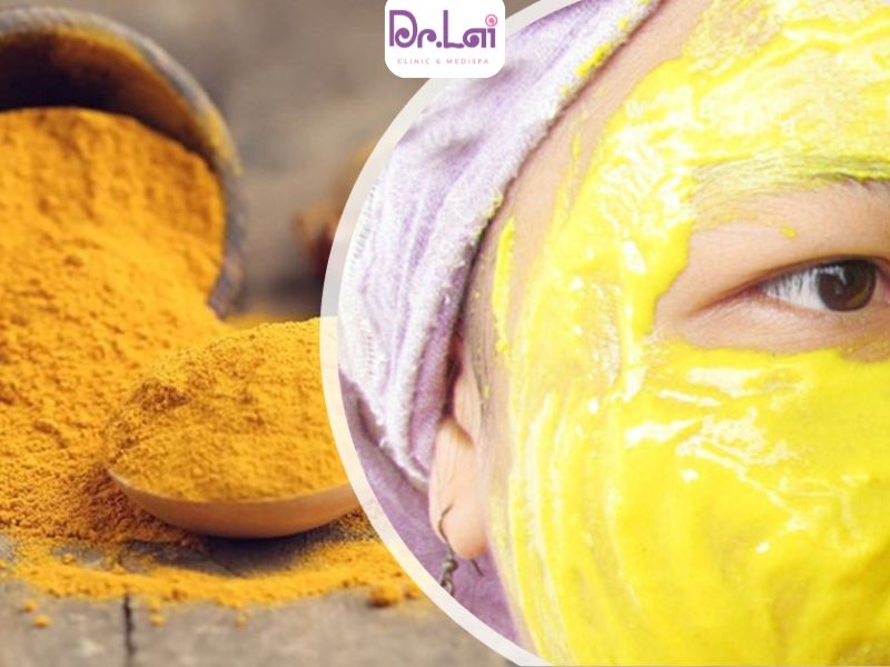 Cách trị thâm mụn ở mặt hiệu quả