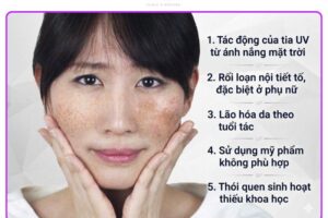 Hướng dẫn cách chăm sóc da bị tàn nhang từ chuyên gia