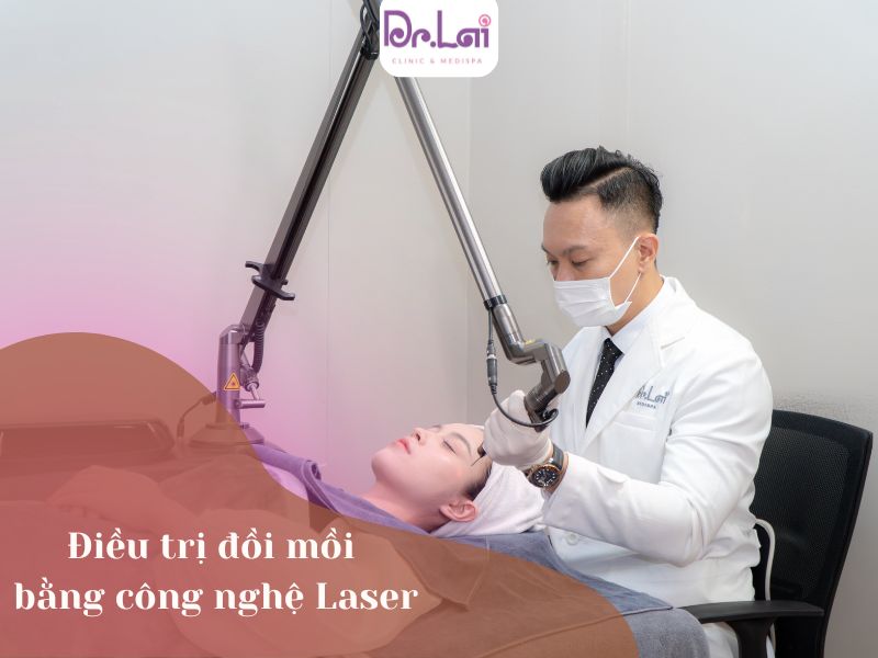 Điều trị đồi mồi bằng công nghệ Laser
