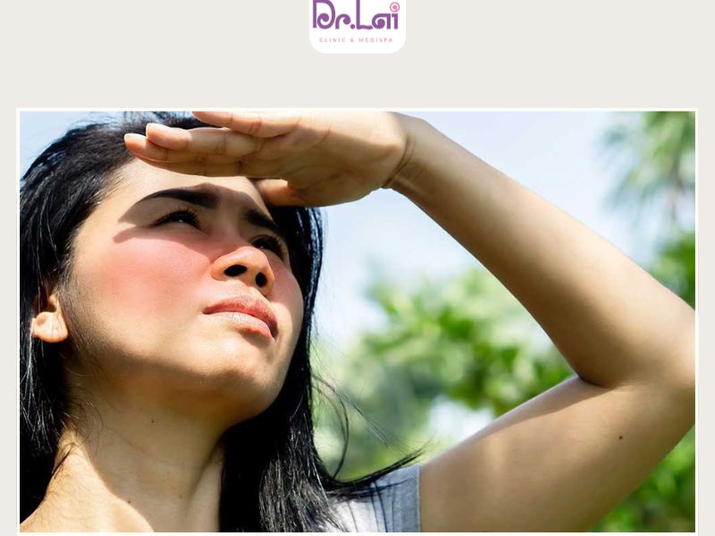 Tia UV là nguyên nhân gây nám da phổ biến nhất