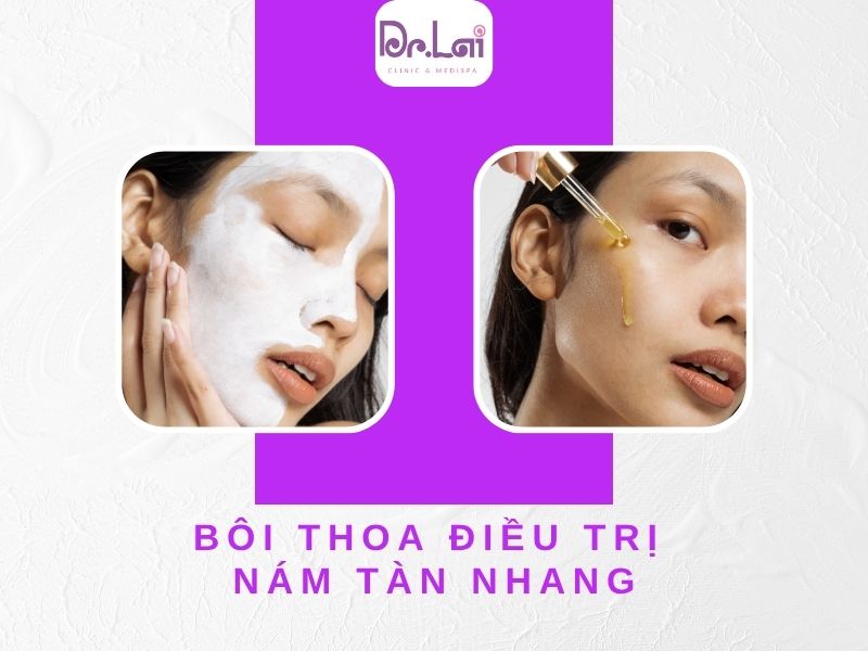 Bôi thoa điều trị nám tàn nhang
