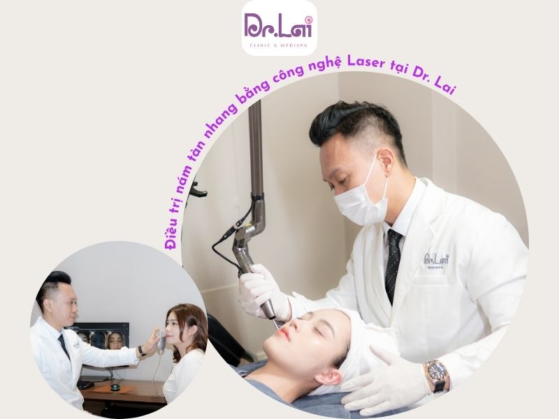 Áp dụng công nghệ cao để điều trị nám, tàn nhang