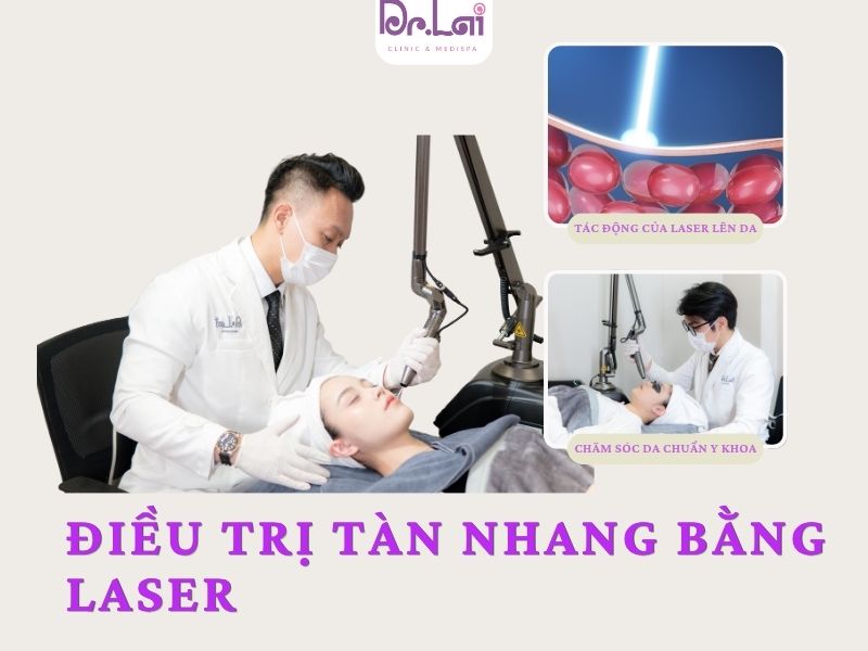 Điều trị tan nhang bằng Laser