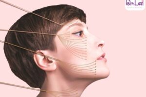 Giải đáp: Căng da mặt có đau không?