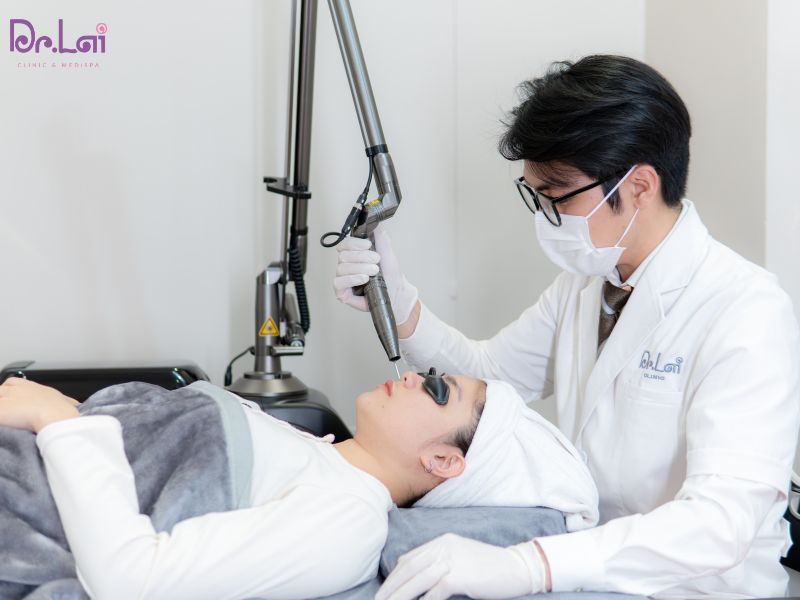 Laser cho hiệu quả cải thiện sắc tố khá nhanh
