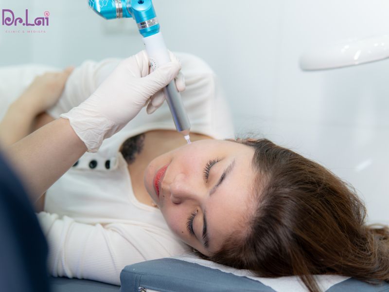 Điều trị nám tàn nhang bằng laser