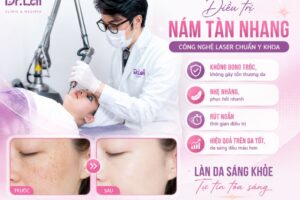 Giải đáp: Có nên điều trị nám tàn nhang bằng laser không?