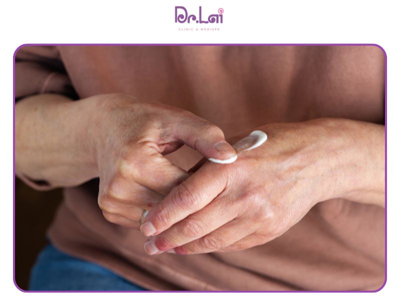 Điều trị bằng thuốc bôi ngoài da