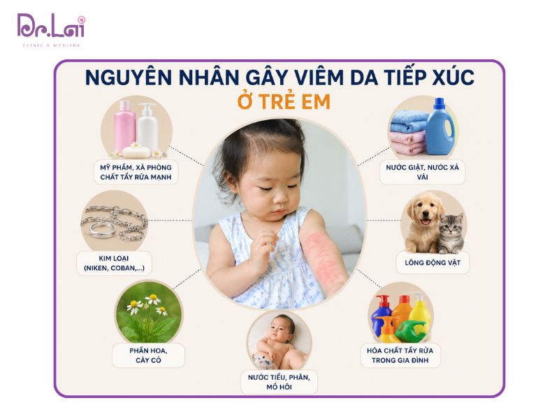 Nguyên nhân gây viêm da tiếp xúc ở trẻ em