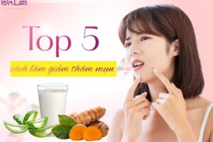 Cách làm giảm thâm mụn nhanh chóng ngay tại nhà