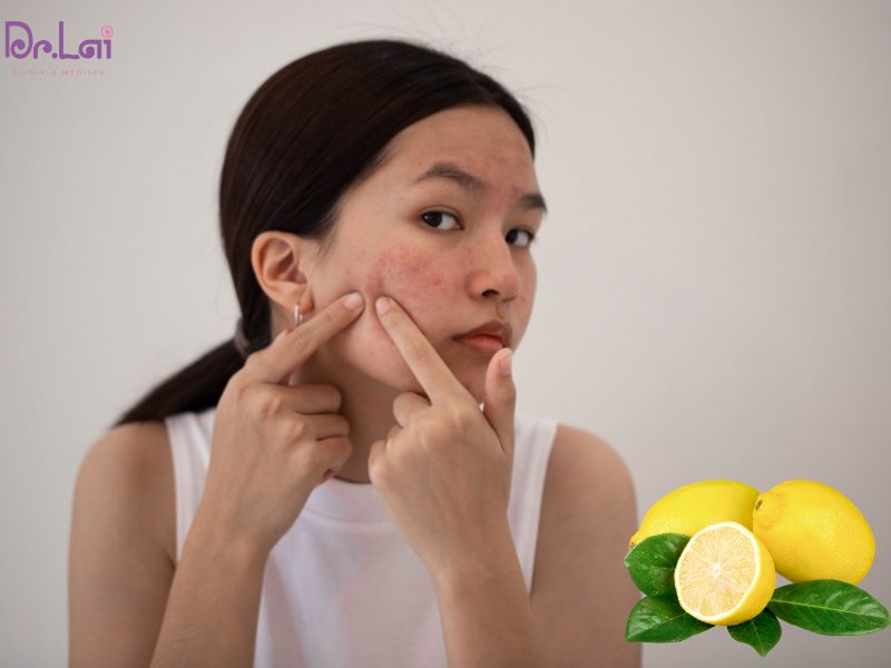 Trị thâm mụn bằng chanh tươi