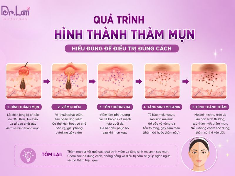 Cách hình thành thâm mụn trên da